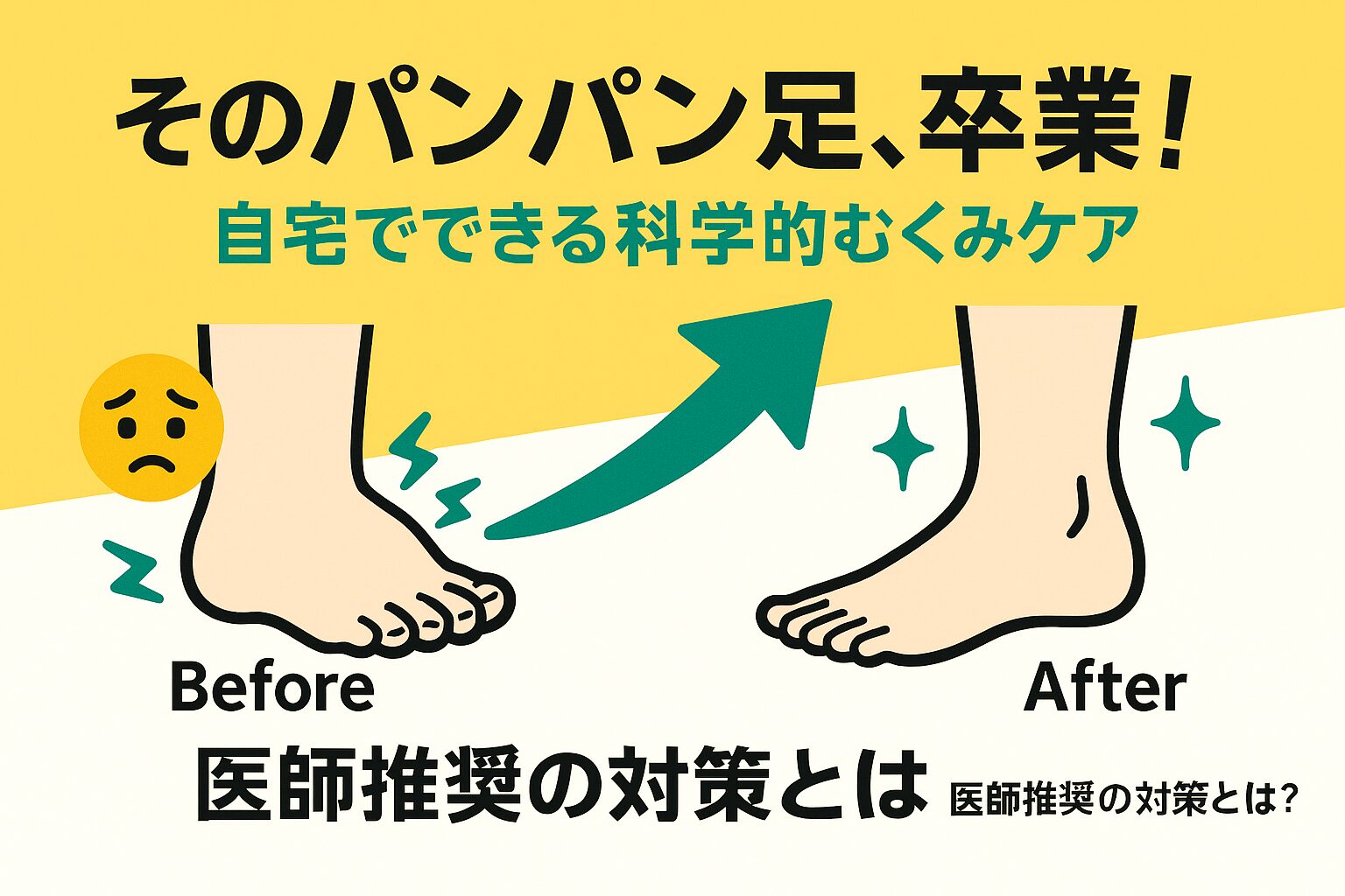 慢性静脈不全による足のむくみを自宅でケアする方法を解説するサムネイル。パンパンにむくんだ足がスッキリした足に変わるビフォーアフターのイラストが描かれている。